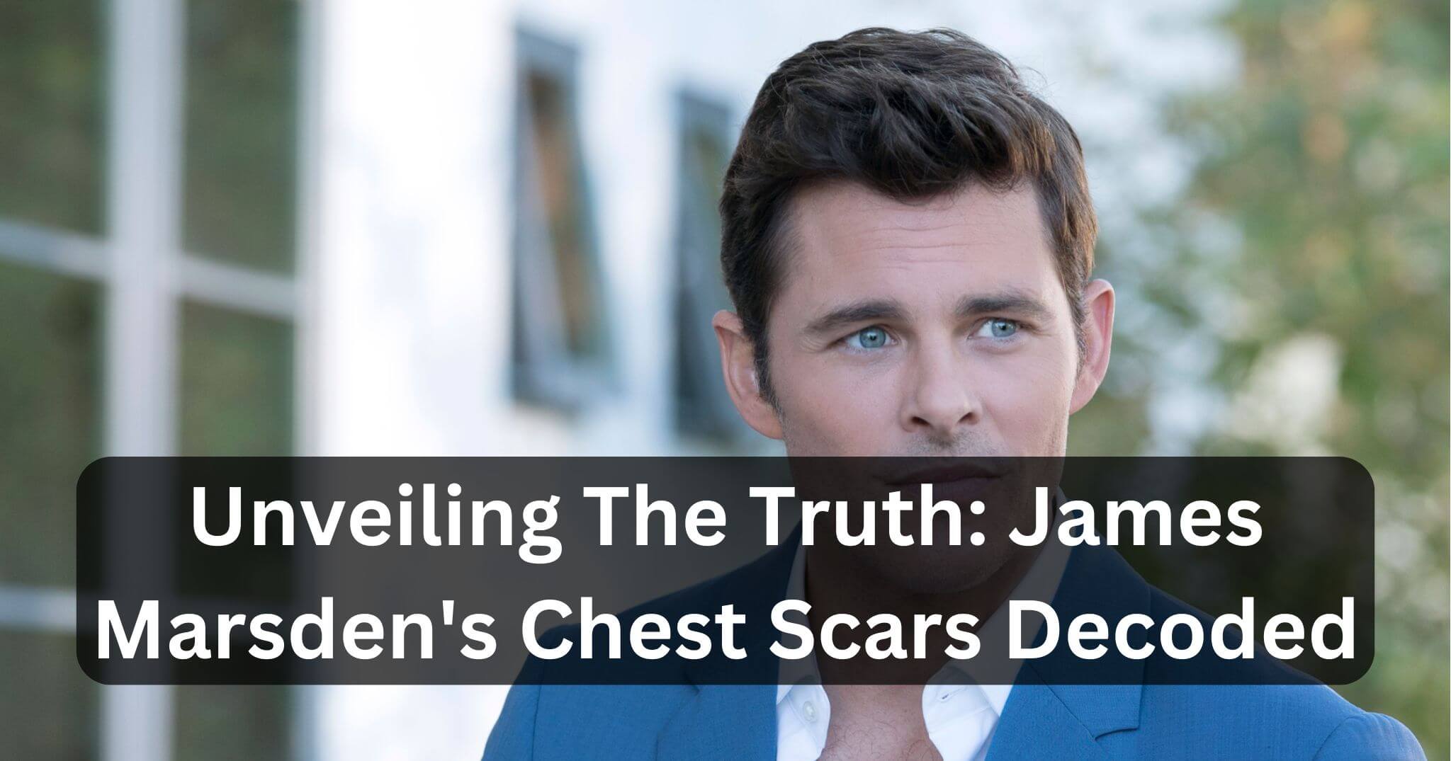 Unveiling The Truth James Marsden's Chest Scars Decoded